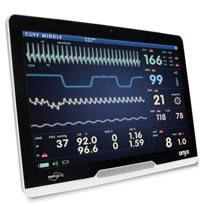 Onyx Mate2 24“, i5-13500TE, 16GB RAM, kapazitiv, 512GB SSD, WiFi6E